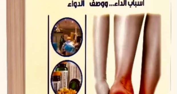 القدم السكري